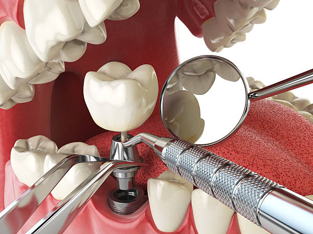 Best Urgent Dental Care for Toothache in Ord, NE